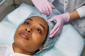 Achieving Your Best Look with Dermal Fillers at Harley Street Dermal Dermal Fillers